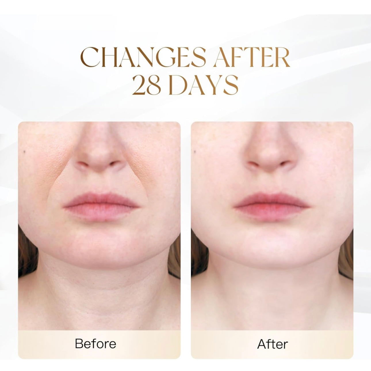 Face Lifting - Wrinkles removal - Jawline definition - ObjectsUAE - 