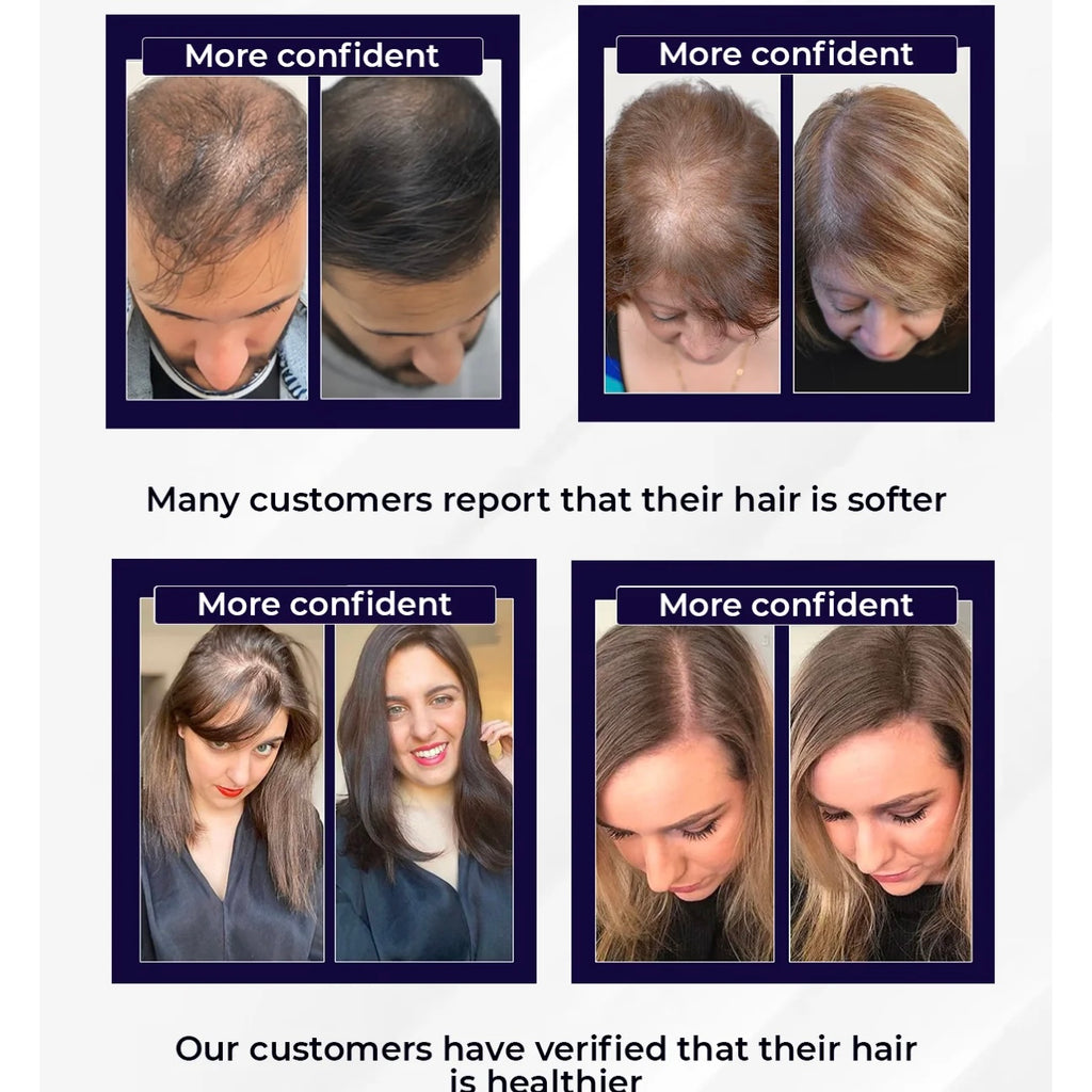 بخّاخ استعادة الشعر الأسرع في 2025